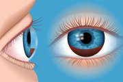 هایفما یا خونریزی داخلی چشم