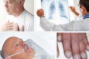 عوارض‌ آمبولی‌ ریه‌ و راه های تشخیص آن