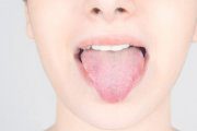 دیابت خود را در دهان چگونه نشان می دهد؟