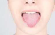 دیابت خود را در دهان چگونه نشان می دهد؟
