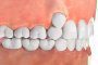 علل دندان های نامرتب