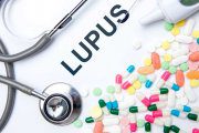 بیماری لوپوس سیستمیک